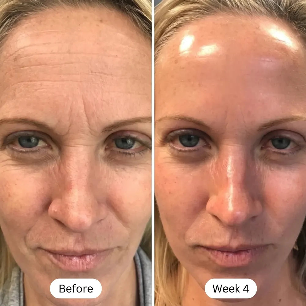 Rosabelle PRO Mask