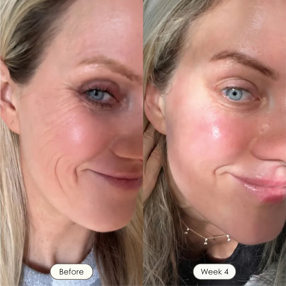 Rosabelle PRO Mask