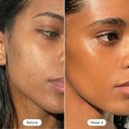 Rosabelle PRO Mask