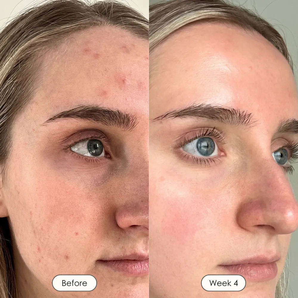 Rosabelle PRO Mask