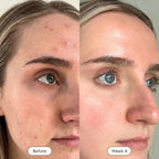 Rosabelle PRO Mask